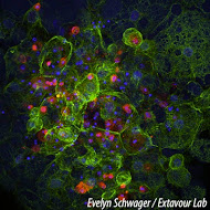 Cell Death in a dying spider embryo