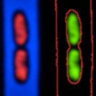 Glimpse at E.Coli Nucleoids