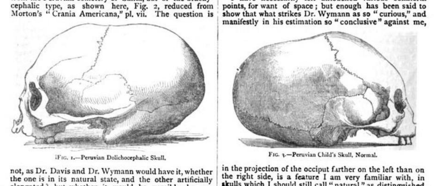 Peruvian skulls