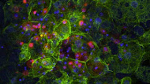 Cell Death in a dying spider embryo
